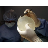 cirurgia para colocar prótese silicone seios Quitandinha