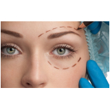cirurgia plástica facial preço Cerro Azul