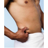 dermolipectomia abdominal completa onde fazer Piraquara