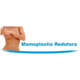 mastopexia redução de mama onde faz Campo Magro