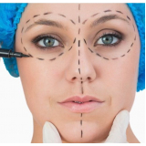 quanto custa cirurgia plástica facial Balsa Nova